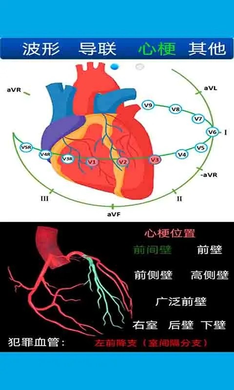 心电图计算器app下载截图